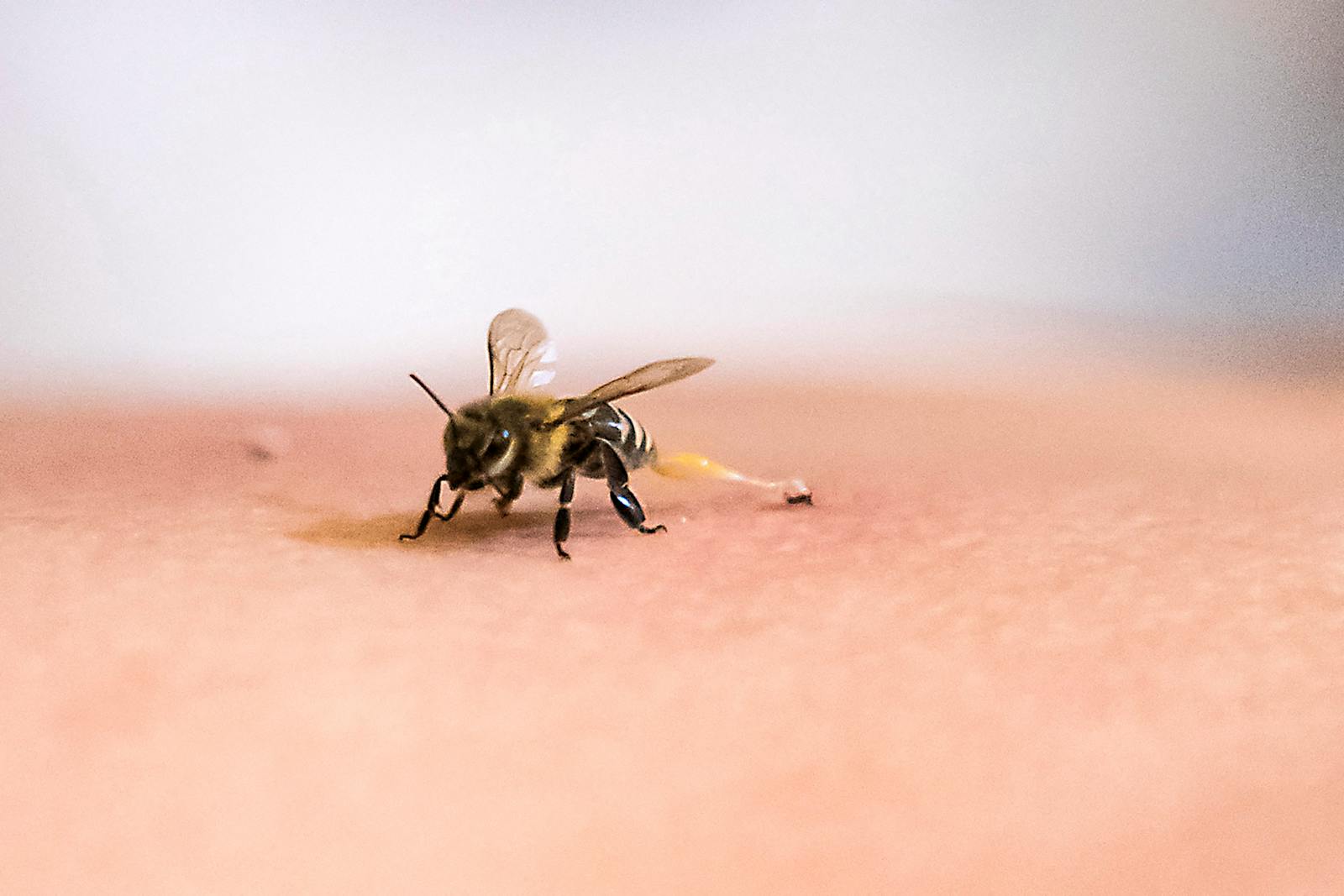 The ancient practice of bee-sting therapy enters a new social-media age thumbnail