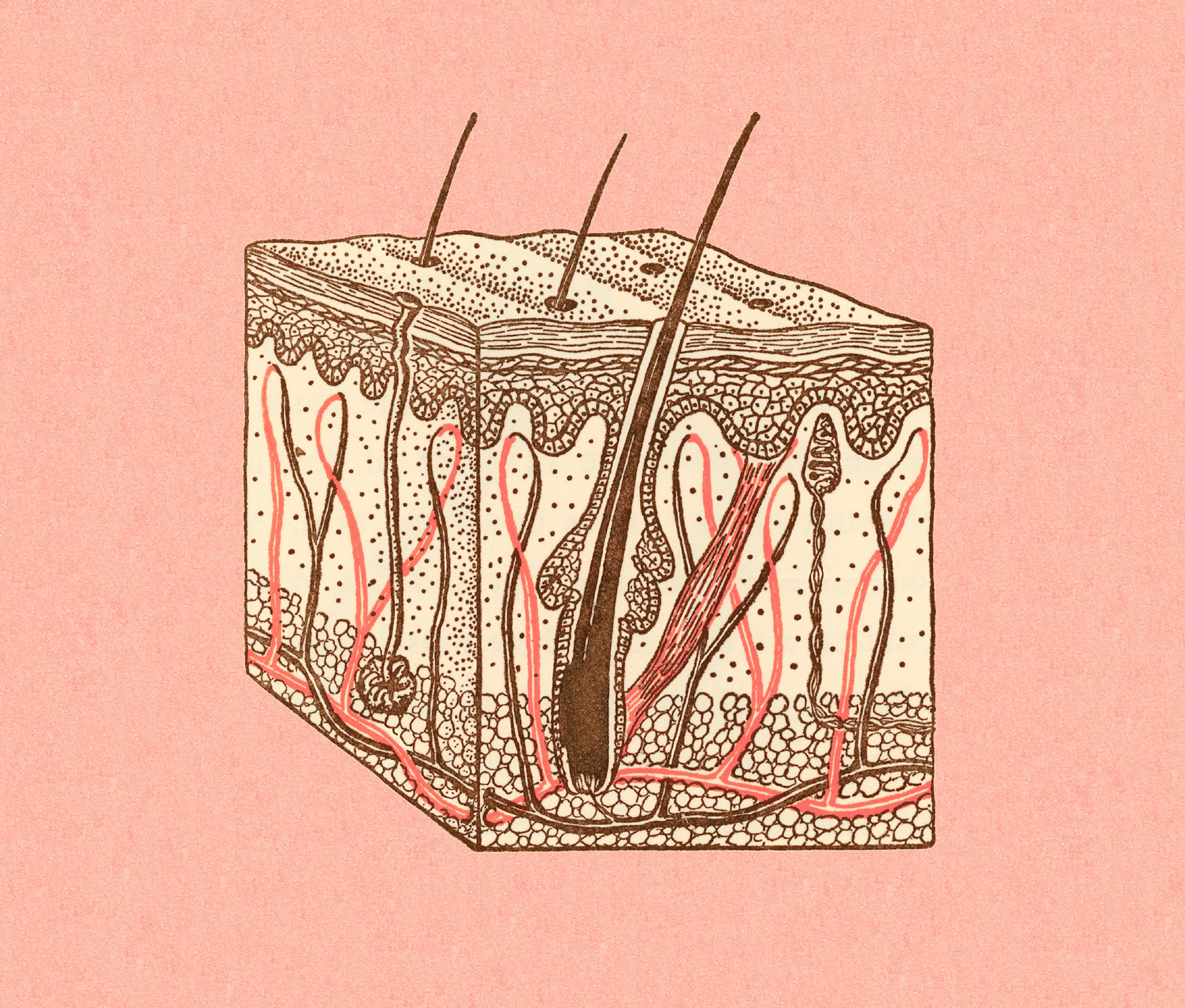 Hair Growing Out of Skin