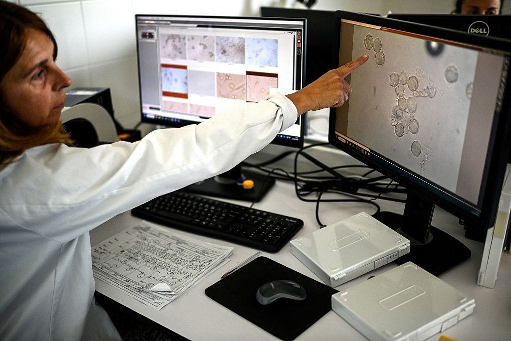 IonQ soars after announcing “significant advancement in quantum chemistry simulations” thumbnail